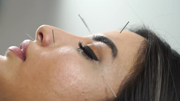 Woman Face's Acupuncture 4K