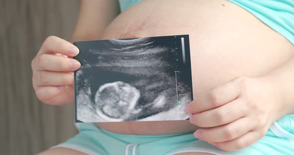 Pregnant woman holding ultrasound baby image in front of her belly 