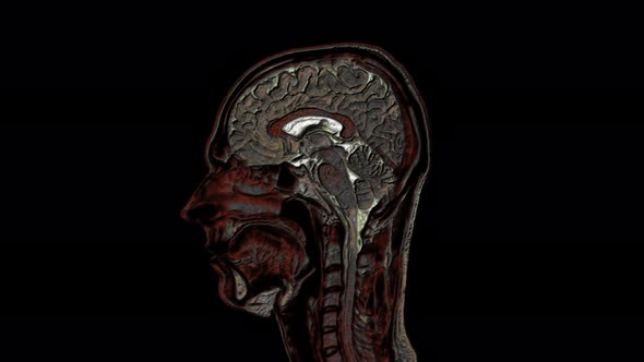 Bulk Multicolored MRI Scans of the Brain and Head To Detect Tumors. Diagnostic Medical Tool