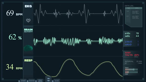Electrocardiogram Display Reading in Normal Mode alt