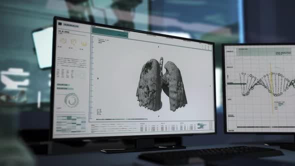 Analysis Of Covid-19 Pneumonia And Its Impact On Human Organism In Software alt