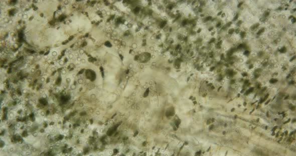 Leech Family Glossiphoniidae Under a Microscope Order Rhynchobdellida