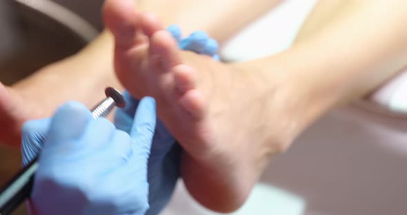 A Pedicure Master Removes Corns From His Feet with a File