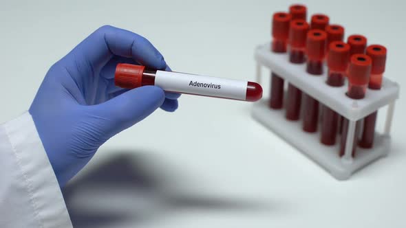 Adenovirus, Doctor Showing Blood Sample in Tube, Lab Research, Health Checkup