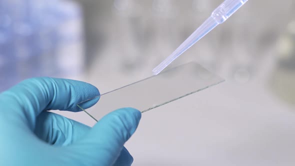 Lab Technician Holding Pipette and Testing Blood Samples on Hospital Ward for Blood Transfusion