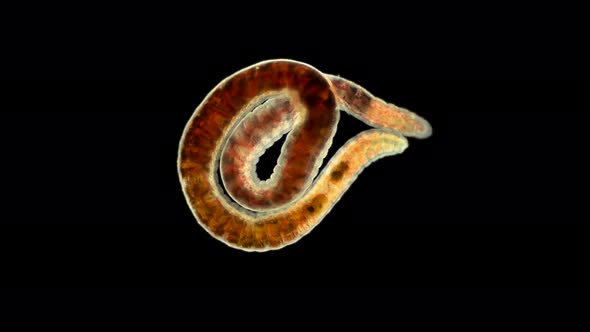 Worm of the Lumbriculidae Family Under a Microscope, Class Clitellata, Oligochaeta Specimen Found 