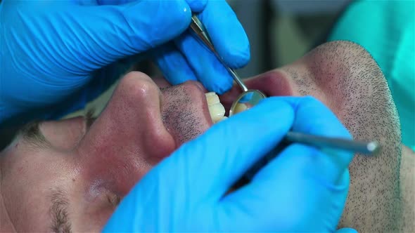 Dentist Checking Patient Mouth