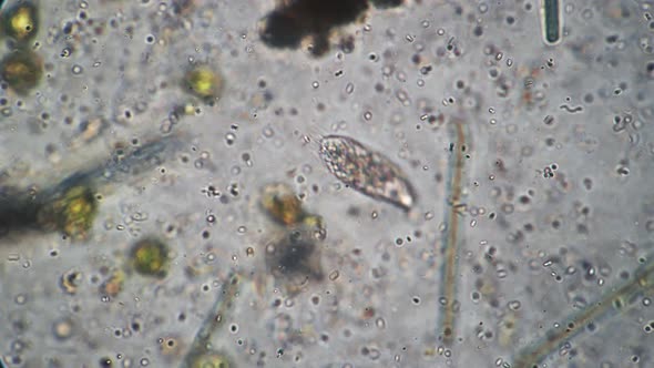 Panoramic Closeup Shot Under a Microscope of Simplest Singlecelled Bacteria Infusorium Slipper