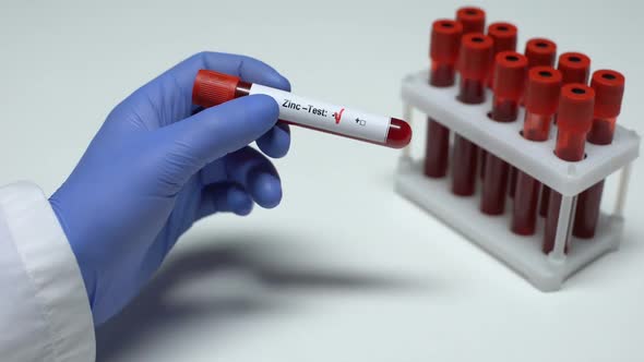 Negative Zinc Test, Doctor Showing Blood Sample, Lab Research, Health Checkup