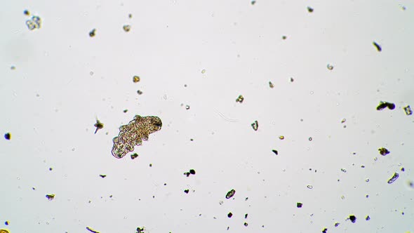 Tardigrade or Water Bear Wakes Up From a Cryptobiosis Timelapse Under a Microscope