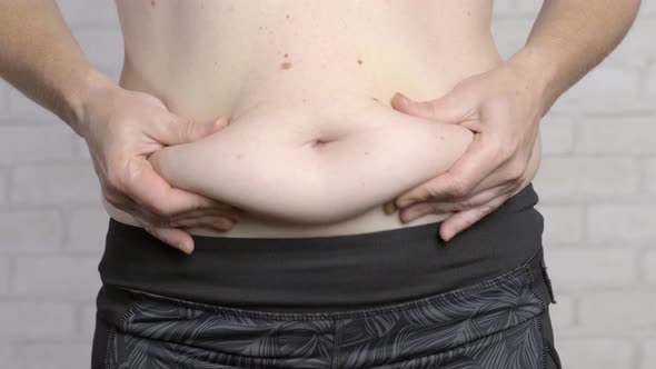 fat flabby belly in adult woman 