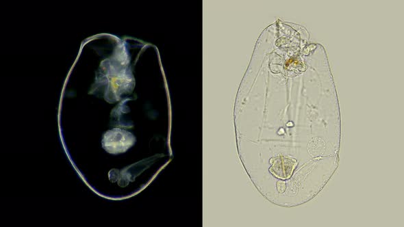 Rotifer Under the Microscope Asplanchna Priodonta, Family Asplanchnidae, Genus Asplanchna