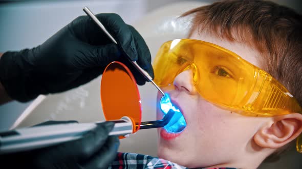 A Little Boy in Protective Glasses Having His Teeth Done - Photopolymer Lamp in the Mouth