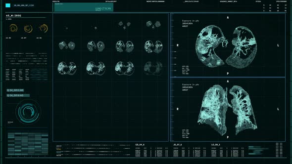 Futuristic organ diagnosis system is analyzing the projection of human lungs