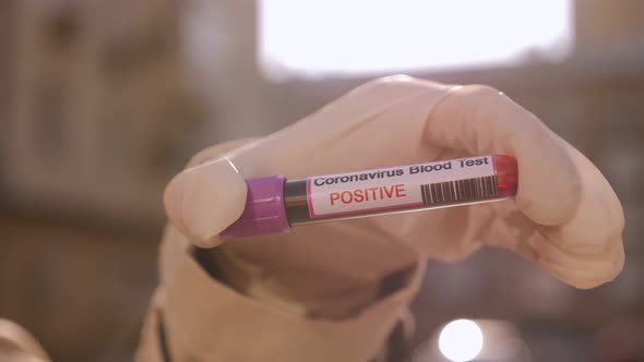 Closeup of a Female Doctor Holding a Positive Blood Test for Coronavirus