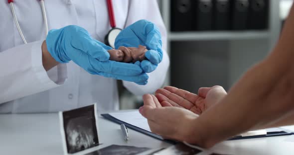 Doctor Transfers Fetus to Woman Hands Before Abortion