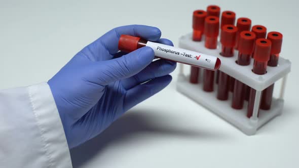 Negative Phosphorus Test, Doctor Showing Blood Sample in Tube, Lab Research