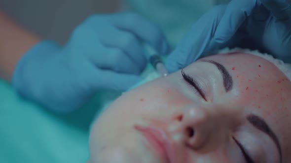 The Beautician Makes a Treatment Procedure to the Patient