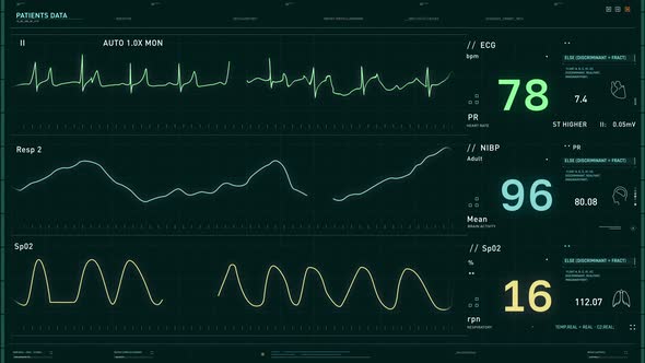 Interface Of Heart Rate Test Equipment Analyzes And Records Patients Health Data