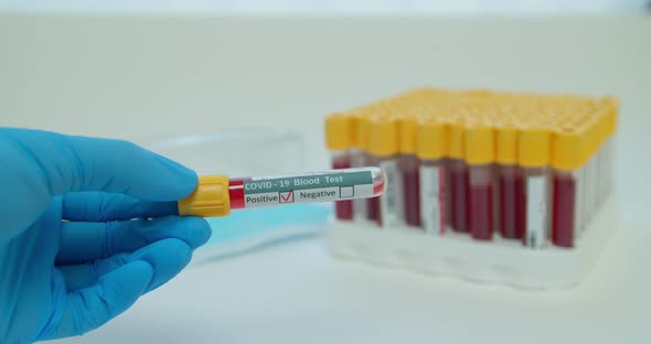 Researcher Hand Showing Tube, Positive Result of Blood Test for Coronavirus, Covid-2.