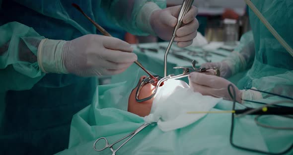 The Doctor Performs a Pediatric Surgical Operation to Remove the Tonsils