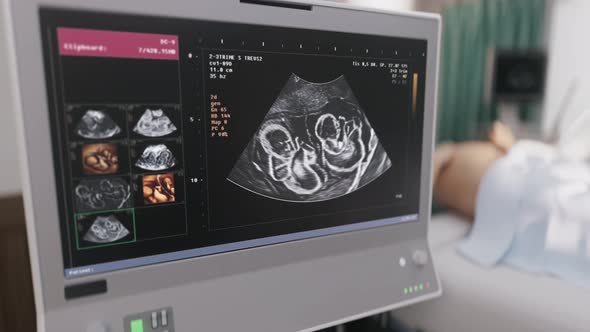 Medical Scanner Examination Of Future Mother Detects Twin Children On Display alt