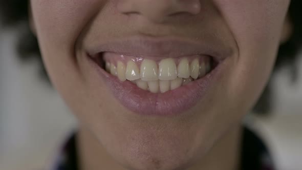 Close of African American Woman Teeth and Smiling