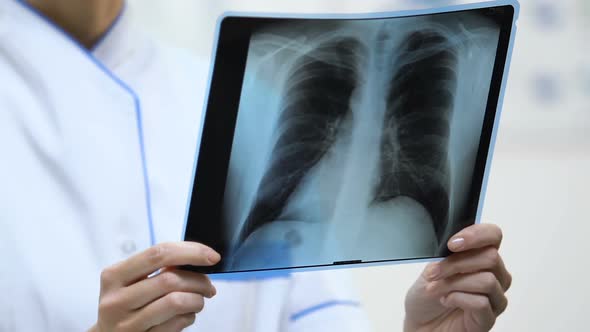 Female Therapist Holding Lung X-Ray, Patient Examination Result, Diagnosis