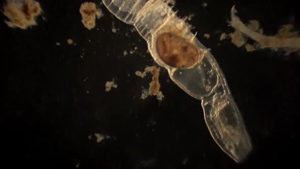 Microscopic ostracod and arthropod with ostracod in it's digestive tract.