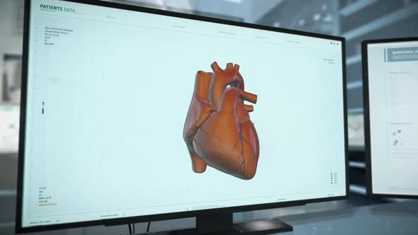 Medical Examination Scanner Technology Checks Heart Organ For Cardiac Ischemia alt