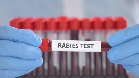Laboratory Assistant Holds Vial with Rabies Test