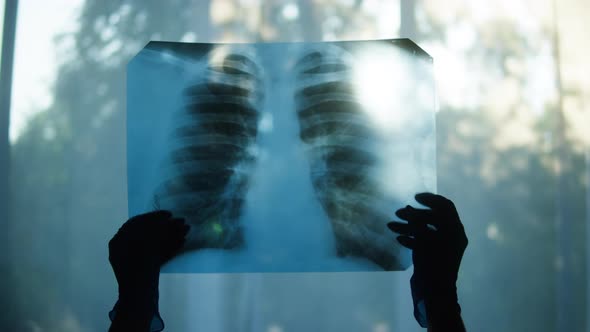 Holding Xray Image of Human Chest on Window Background Doctor Checking Fluorography of Patient on