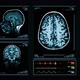 Brain MRI Scan. Blue. 3 videos in 1 file. Loopable. Medical Background. - VideoHive Item for Sale