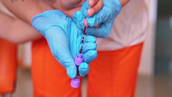 Doctor testing of patient blood. Close up view of hands doctor testing his patients blood 