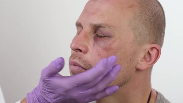 Doctor Examines Bruise Under the Eye