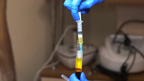 Close-up of a nurse's hand in blue rubber gloves drawing yellow plasma into a syringe