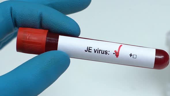 JE Virus, Doctor Holding Blood Sample in Tube Close-Up, Health Examination