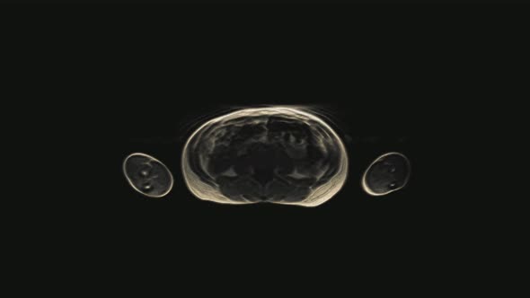 Voluminous Color MRI of the Female Pelvic Organs, Abdominal Cavity, Gastrointestinal Tract and