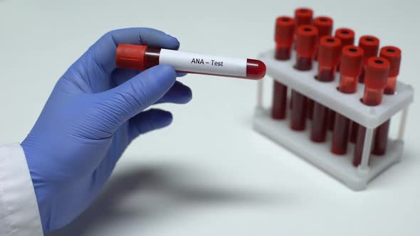 ANA Test, Doctor Showing Blood Sample in Tube, Lab Research, Health Checkup