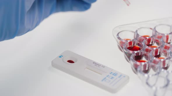 Sequence of Scientists Testing Blood for Covid-19