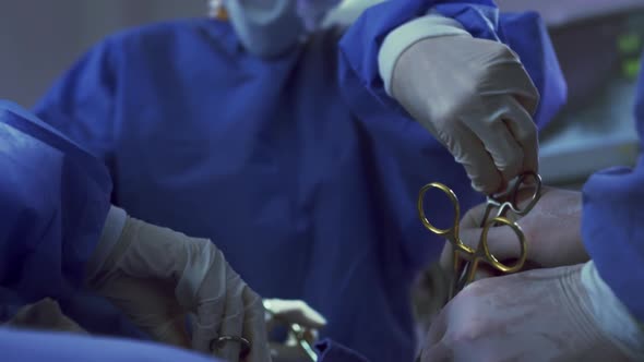 Close-up of Multi-ethnic surgeons performing surgery in operation theater at hospital