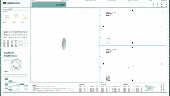 Medical Examination Of Heart Organ Finds Symptoms Of Cardiac Ischemia Illness alt