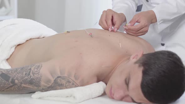 Unrecognizable Acupuncturist Disconnecting Electricity From Needles. Brunette Young Caucasian Man