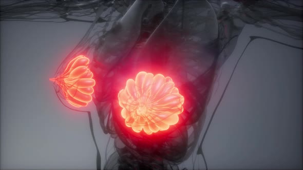 Medically Accurate Illustration of an Obese Womens Mammary Glands alt