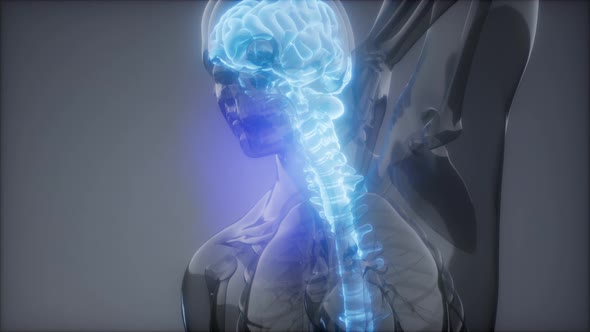 Backache in Back Bones alt