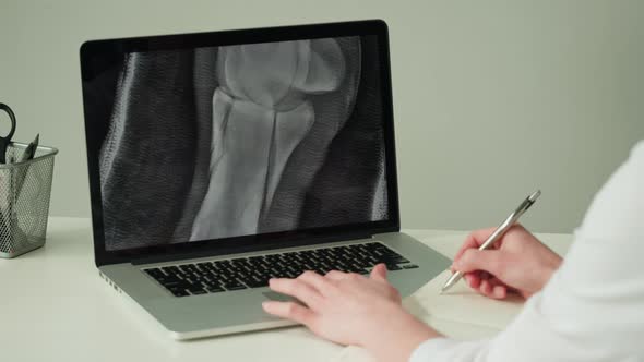 Doctor Veterinarian Examining Horse Leg Skeleton Roentgen on Laptop Monitor