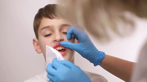 Dentist examines the baby teeth. Painless dental treatment, caries in children