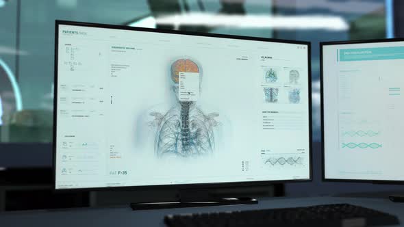 Advanced Anatomical Examination System Scanning Patient At Medical Laboratory alt