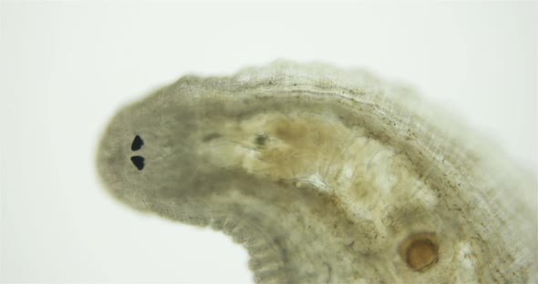 Eech Family Glossiphoniidae Under a Microscope