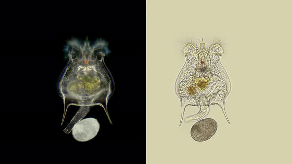 Rotifers Brachionus Sp. Under a Microscope, of the Family Brachionidae, Order Ploima, Planktonic